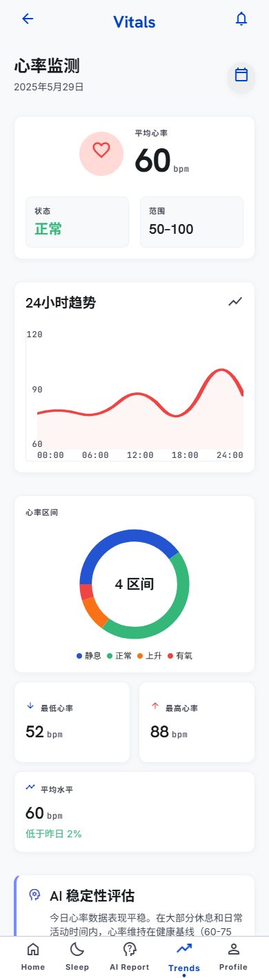 心率监测详情